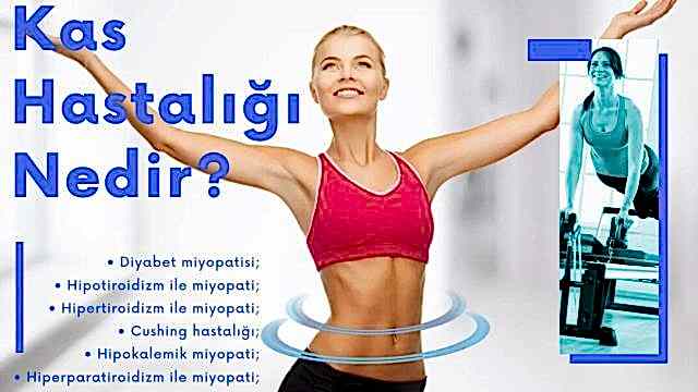 kas hastalığı nedir